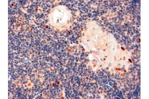 Immunohistochemistry (IHC) image for anti-Autoimmune Regulator (AIRE) (C-Term) antibody (ABIN184780)