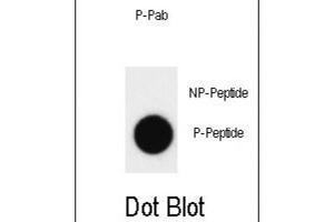 Dot Blot (DB) image for anti-C-Abl Oncogene 1, Non-Receptor tyrosine Kinase (ABL1) (pTyr412) antibody (ABIN3001744)