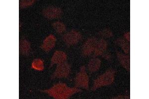 ABIN6269146 staining A549 cells by ICC/IF. (Cyclin B1 antibody  (Internal Region))