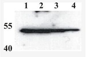 Western Blotting (WB) image for anti-BPV-1 (AA 208-218) antibody (ABIN781764) (BPV-1 (AA 208-218) antibody)