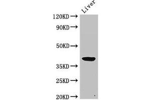 Western Blot Positive WB detected in: Rat liver tissue All lanes: ADH5 antibody at 2 μg/mL Secondary Goat polyclonal to rabbit IgG at 1/50000 dilution Predicted band size: 40 kDa Observed band size: 40 kDa (ADH5 antibody  (AA 14-130))