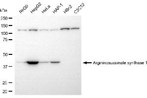 Western blotting analysis using argininosuccinate synthase 1 antibody (ABIN7797647). (ASS1 antibody)