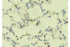 ABIN6273695 at 1/100 staining Mouse lung tissue by IHC-P. (PLCE1 antibody)