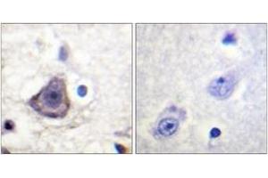 Immunohistochemistry analysis of paraffin-embedded human brain, using HER3 (Phospho-Tyr1222) Antibody. (ERBB3 antibody  (pTyr1222))