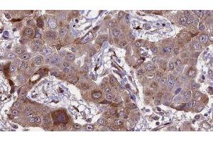Immunohistochemistry (IHC) image for anti-Fc Fragment of IgG, Low Affinity IIa, Receptor (CD32) (FCGR2A) (C-Term) antibody (ABIN6261701)