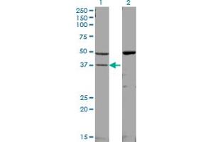 Western Blot analysis of MAPK14 expression in transfected 293T cell line by MAPK14 monoclonal antibody (M01), clone 3D5. (MAPK14 antibody  (AA 260-360))