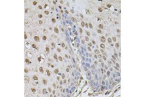 Immunohistochemistry of paraffin-embedded human esophagus using CCNA2 antibody. (Cyclin A antibody  (AA 1-200))