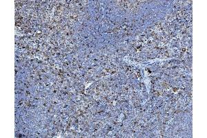 IHC analysis of P4HB using anti-P4HB antibody (ABIN7600075). (P4HB antibody  (AA 146-363))