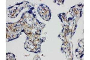 Anti-SNAP23 antibody, IHC(P) IHC(P): Human Placenta Tissue (SNAP23 antibody  (C-Term))