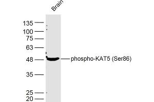 Mouse brain lysates probed with KAT5 (Ser86) Polyclonal Antibody, Unconjugated  at 1:300 dilution and 4˚C overnight incubation. (KAT5 antibody  (pSer86))