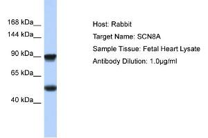 Host: Rabbit Target Name: SCN8A Sample Type: Fetal Heart lysates Antibody Dilution: 1.