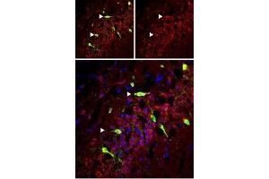 Expression of mGluR5 in rat hippocampusImmunohistochemical staining of perfusion-fixed frozen rat hippocampus sections using Anti-mGluR5 (extracellular) Antibody (ABIN7043250, ABIN7044332 and ABIN7044333), (1:50). (Glutamate Receptor, Metabotropic 5 (GRM5) Peptide)