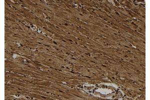 ABIN6278650 at 1/100 staining Rat heart tissue by IHC-P. (CSNK1A1 antibody  (pTyr294))