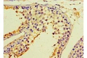 Immunohistochemistry of paraffin-embedded human testis tissue using ABIN7146575 at dilution of 1:100 (Calreticulin 3 antibody  (AA 135-384))
