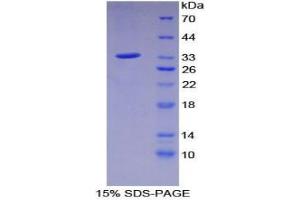 SDS-PAGE analysis of Mouse C2CD3 Protein. (C2CD3 Protein)