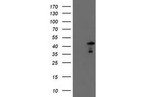 HEK293T cells were transfected with the pCMV6-ENTRY control (Left lane) or pCMV6-ENTRY SERPINA5 (Right lane) cDNA for 48 hrs and lysed. (SERPINA5 antibody)