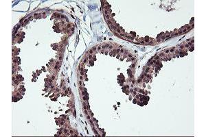 Immunohistochemical staining of paraffin-embedded Human breast tissue using anti-NHEJ1 mouse monoclonal antibody. (NHEJ1 antibody)