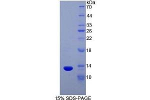 SDS-PAGE (SDS) image for Chemokine (C Motif) Ligand 1 (XCL1) (AA 27-107) protein (His tag,T7 tag) (ABIN1878688) (XCL1 Protein (AA 27-107) (His tag,T7 tag))