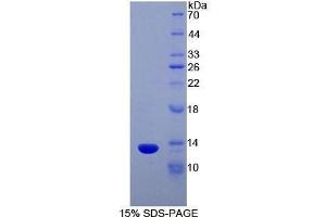 SDS-PAGE (SDS) image for Chemokine (C Motif) Ligand 1 (XCL1) (AA 27-107) protein (His tag,T7 tag) (ABIN1878688)