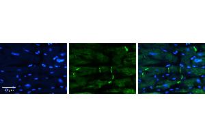 Rabbit Anti-PERP Antibody   Formalin Fixed Paraffin Embedded Tissue: Human heart Tissue Observed Staining: Plasma membrane in intercalated disk Primary Antibody Concentration: 1:100 Other Working Concentrations: 1:600 Secondary Antibody: Donkey anti-Rabbit-Cy3 Secondary Antibody Concentration: 1:200 Magnification: 20X Exposure Time: 0.