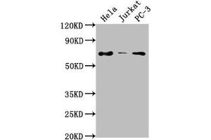Western Blot Positive WB detected in: Hela whole cell lysate, Jurkat whole cell lysate, PC-3 whole cell lysate All lanes: PRICKLE3 antibody at 1:2000 Secondary Goat polyclonal to rabbit IgG at 1/50000 dilution Predicted band size: 69, 60 kDa Observed band size: 69 kDa (PRICKLE3 antibody  (AA 9-24))