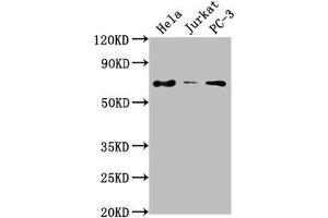 PRICKLE3 antibody  (AA 9-24)