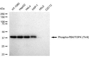 Western blotting analysis using Phospho-PBK/TOPK (Thr9) antibody (ABIN7799752).