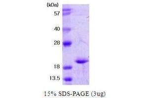 Figure annotation denotes ug of protein loaded and % gel used. (SOD1 Protein (AA 1-154))