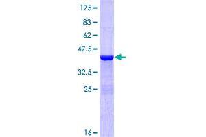 TCL1A Protein (AA 1-114) (GST tag)