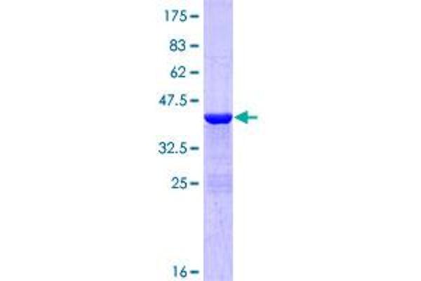 TCL1A Protein (AA 1-114) (GST tag)