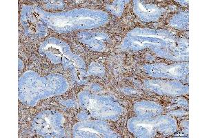 IHC analysis of FN1 using anti-FN1 antibody (ABIN7603470). (Fibronectin 1 antibody)