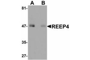 Image no. 1 for anti-Receptor Accessory Protein 4 (REEP4) (Internal Region) antibody (ABIN478105)