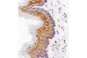 Immunohistochemical analysis of paraffin-embedded R. (EGFR antibody  (C-Term))