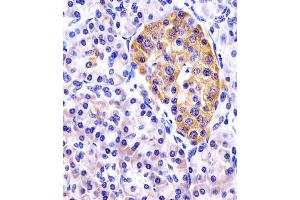 Immunohistochemistry (Paraffin-embedded Sections) (IHC (p)) image for anti-DNA-Damage-Inducible Transcript 4 (DDIT4) (AA 20-49), (N-Term) antibody (ABIN390207)