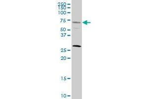 SRF monoclonal antibody (M02), clone 1C8. (SRF antibody  (AA 406-508))