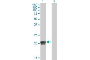 Western Blot analysis of RGS5 expression in transfected 293T cell line by RGS5 MaxPab polyclonal antibody. (RGS5 antibody  (AA 1-181))