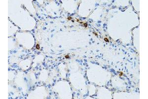 Immunohistochemistry of paraffin-embedded rat lung using TEFM antibody (ABIN5974873) at dilution of 1/100 (40x lens).