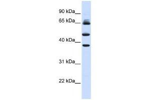 FBXL3 antibody used at 1 ug/ml to detect target protein. (FBXL3 antibody  (Middle Region))
