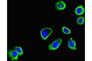 Immunofluorescent analysis of HepG2 cells using ABIN7148597 at dilution of 1:100 and Alexa Fluor 488-congugated AffiniPure Goat Anti-Rabbit IgG(H+L) (CORO1B antibody  (AA 252-453))