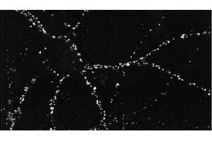 Immunocytochemistry/Immunofluorescence analysis using Mouse Anti-PSD95 Monoclonal Antibody, Clone 6G6 . (DLG4 antibody  (PE))