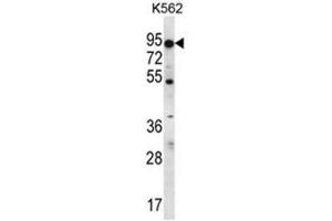 ABCD2 Antibody (Abcd2 antibody  (C-Term))