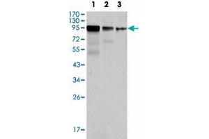 Western blot analysis using FER monoclonal antibody, clone 5D2C4  against NIH/3T3 (1) , A-549 (2) and SK-MEL-5 (3) cell lysate.
