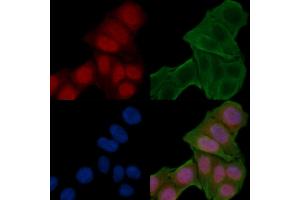 ABIN6258775 and ABIN6274251 staining Hela cells(24h of starvation treatment) by IF/ICC.