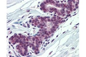PCBP1 antibody was used for immunohistochemistry at a concentration of 4-8 ug/ml. (PCBP1 antibody)