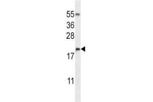 DROSHA antibody  (AA 124-151)
