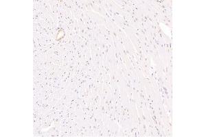 Immunohistochemistry analysis of paraffin embedded mouse heart using Zfpm2 (ABIN7076277) at dilution of 1: 3600 (ZFPM2 antibody)
