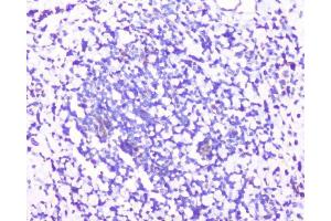 IHC analysis of RPS3 using anti-RPS3 antibody (ABIN6719371). (RPS3 antibody)