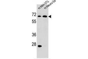 Western blot analysis of NAD-ME Antibody (C-term) in mouse NIH-3T3,Neuro-2a cell line lysates (35ug/lane). (NAD-ME antibody  (C-Term))