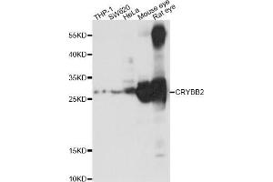 Western blot analysis of extracts of various cell lines,ing CRYBB2 antibody (ABIN5969861) at 1/1000 dilution. (CRYbB2 antibody)