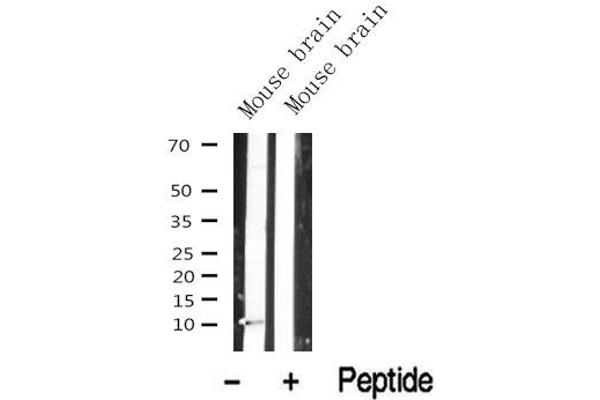 PDE6G antibody  (Internal Region)